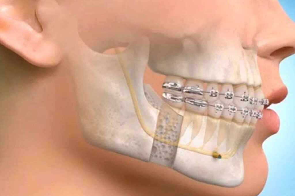 جراحی فک دکتر میلاد پروین بوشهر